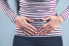 PCOS and Acne Explained